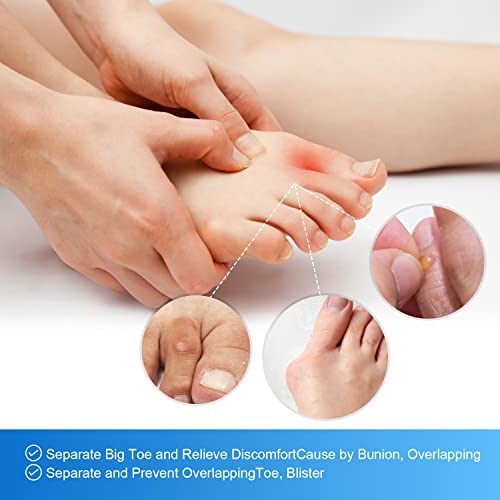 Bukihome 16 Packs Toe Separators for Overlapping Toes Women Gel Silicone Toe ...