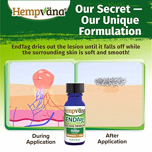 Hempvana EndTag Skin Tag Remover, Enriched with Hemp Seed Oil, Mess-Free, Eas...