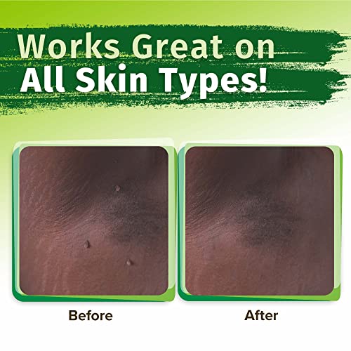 Hempvana EndTag Skin Tag Remover, Enriched with Hemp Seed Oil, Mess-Free, Eas...