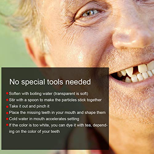 Tooth Repair Bead, Broken Teeth Repair, Multi functional Temporary Tooth Repa...