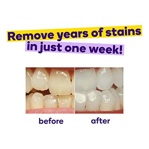 BURST Teeth Whitening Strips with Coconut Oil, 7 Treatments