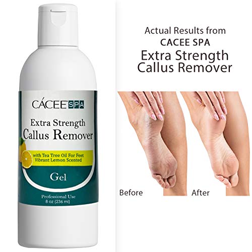 Cacee Callus Remover for Feet 8oz, Gel Formula with Tea Tree Oil & Lemon Scen...
