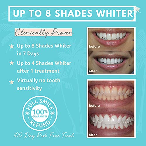 Cali White Teeth Whitening Kit with LED Light, Organic Peroxide Teeth Whiteni...