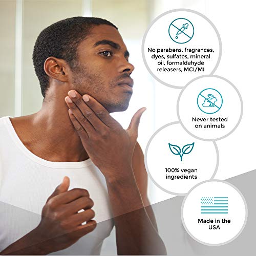 Calysta Labs Acne Serum with Retinol, Witch Hazel, Rose & Natural Anti Aging ...