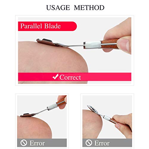 Foot Razor for Callus Removal - Calusses Shaver, Wood Handle Foot Shaver Call...