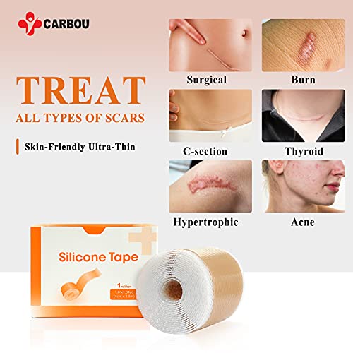 Carbou Silicone Scar Tape (1.6” x 60”Roll),Medical Silicone Easy-Tear Gel Tap...