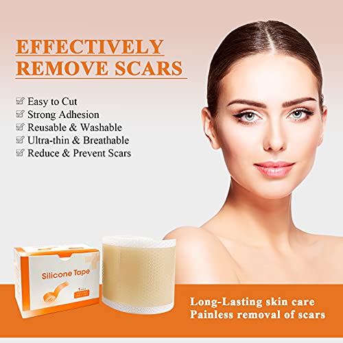 Carbou Silicone Scar Tape (1.6” x 60”Roll),Medical Silicone Easy-Tear Gel Tap...