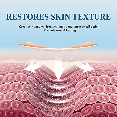 Carbou Silicone Scar Tape (1.6” x 60”Roll),Medical Silicone Easy-Tear Gel Tap...