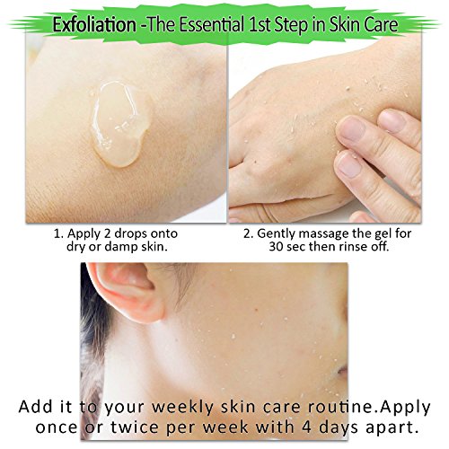 Facial Peeling Gel, Exfoliant for Dry and Flaky Skin, Non-Scrub Exfoliation R...