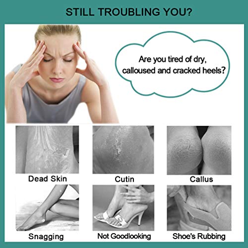 CAREHOOD Foot File Callus Remover - Multi Purpose 4 in 1 Feet Pedicure Tools ...