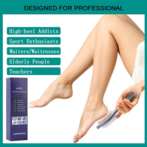 CAREHOOD Foot File Callus Remover - Multi Purpose 4 in 1 Feet Pedicure Tools ...