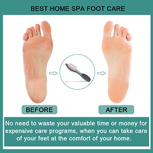 CAREHOOD Foot File Callus Remover - Multi Purpose 4 in 1 Feet Pedicure Tools ...