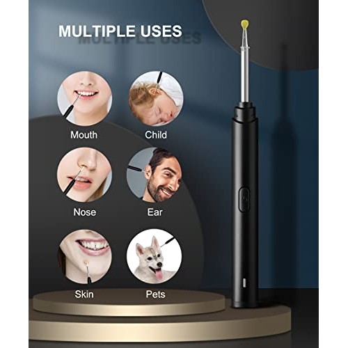Ear Wax Removal Tool, 1296P Ear Cleaner Camera, 6 LED Lights, WiFi Ear Cleani...
