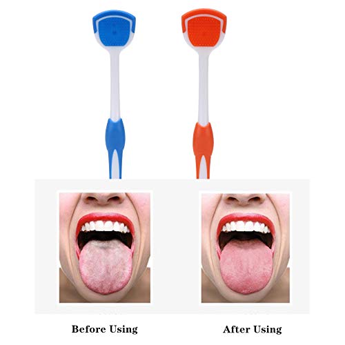 2 Pack Tongue Scraper, Tongue Cleaner Brush for Adults Tongue Scrubber for Be...