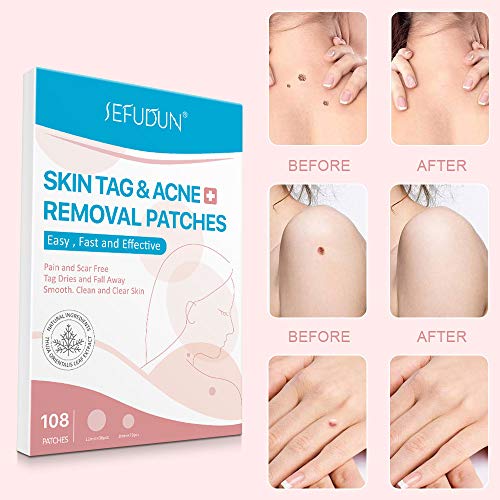 Skin Tag Remover Patches 108 PCS, Acne Tag Mole Remover Patch Natural Safe Ef...