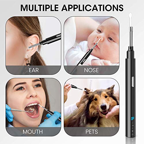 Chanarily Ear Wax Removal with Camera, Earwax Cleaner, Wireless Ear Endoscope...