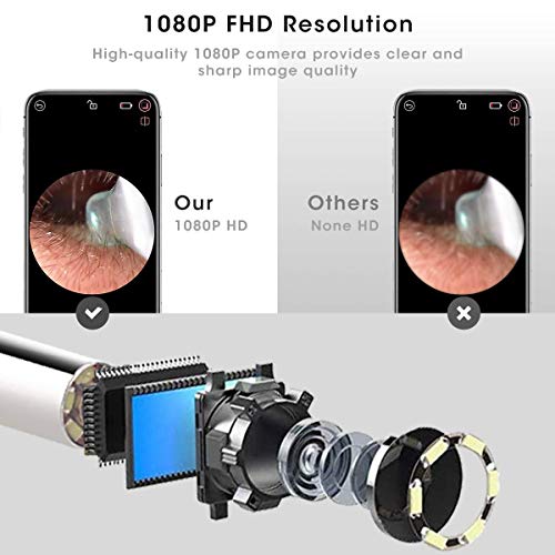 Chanarily Ear Wax Removal with Camera, Earwax Cleaner, Wireless Ear Endoscope...