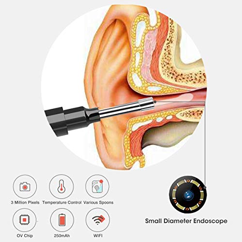 Chanarily Ear Wax Removal with Camera, Earwax Cleaner, Wireless Ear Endoscope...