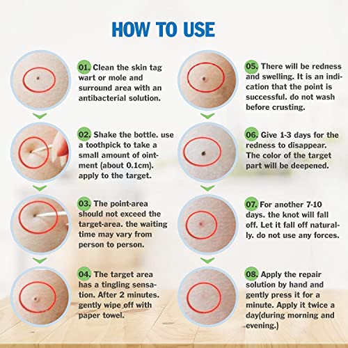 Skin Tag Removal - All Natural Mole and Skin Tag Remover and Repair Lotion- L...