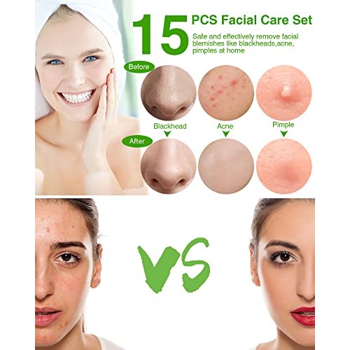 15 PCS Blackhead Remover Pimple Popper Tool Kit,Black Head Remove Extractor f...