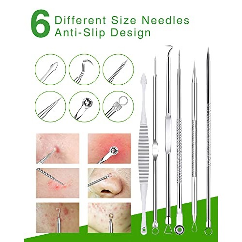 15 PCS Blackhead Remover Pimple Popper Tool Kit,Black Head Remove Extractor f...