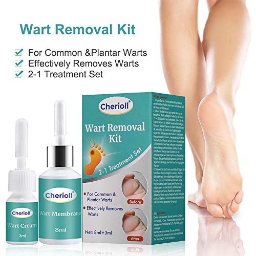 Wart Remover, Plantar Wart Removal, Corn Callus Remover, Wart Removal with Na...