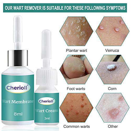 Wart Remover, Plantar Wart Removal, Corn Callus Remover, Wart Removal with Na...