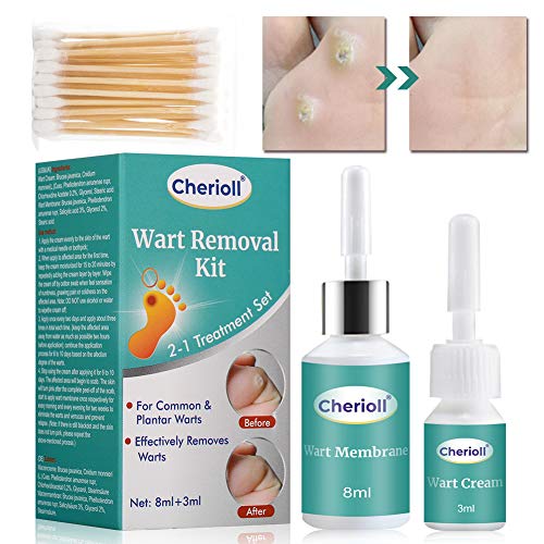 Wart Remover, Plantar Wart Removal, Corn Callus Remover, Wart Removal with Na...