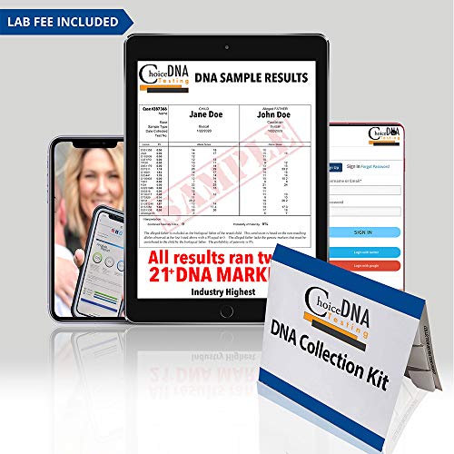 Twin Zygosity DNA Test Kit (At Home - For Personal Purposes Only) – Free Retu...