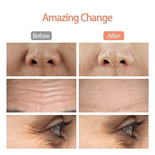 Stainless Steel Face Roller with Travel Pouch, Face Massager Roller for Face,...