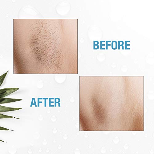 Clean + Easy Non-Laser Personal Electrolysis for Face and Body, Permanent Hai...