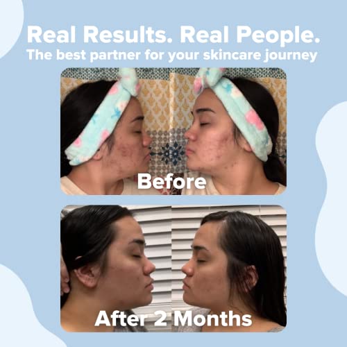 Clean Skin Club Clean Towels | Worlds 1ST Biodegradable Face Towel | Disposab...