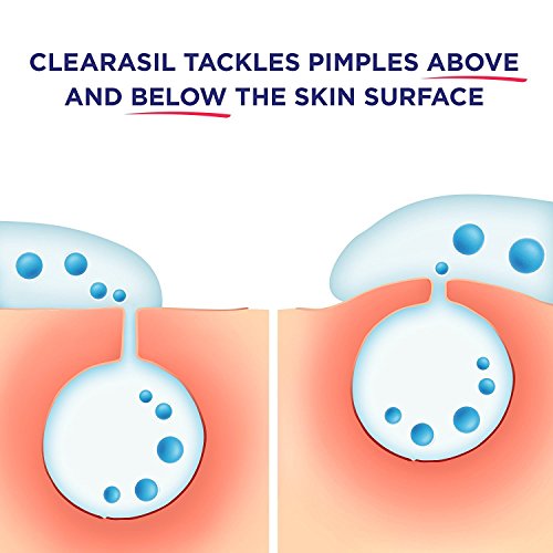 Acne Treatment Facial Cleansing Pads- Clearasil Rapid Rescue Deep Treatment P...