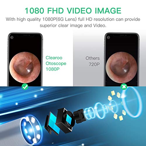 Ear Wax Removal Tool, Clearoo Ear Cleaner, Earwax Removal Kit, Ear Camera, Wi...