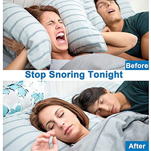 Comezy Anti Snoring Devices - 12 Stop Snoring Nose Vents for Travel & Home Sl...