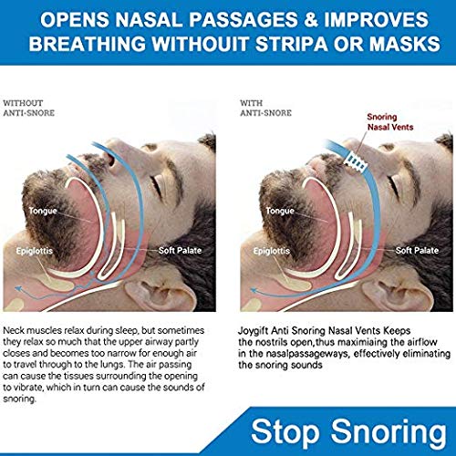 Comezy Anti Snoring Devices - 12 Stop Snoring Nose Vents for Travel & Home Sl...