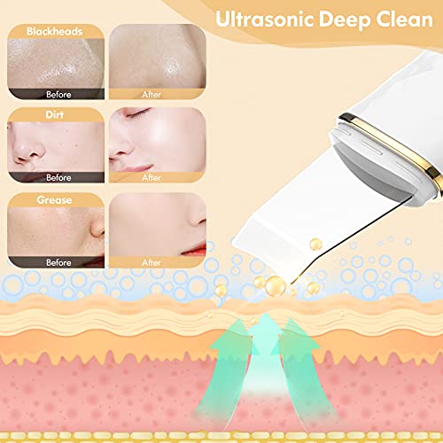 Skin Scrubber Face Spatula, Blackhead Remover Pore Cleaner with LCD Display, ...
