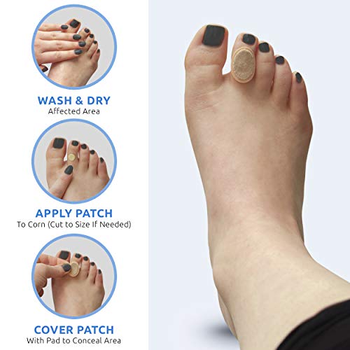 Comfort Zone Corn Removers Medicated Patches, Effective Corn Removal Pads wit...