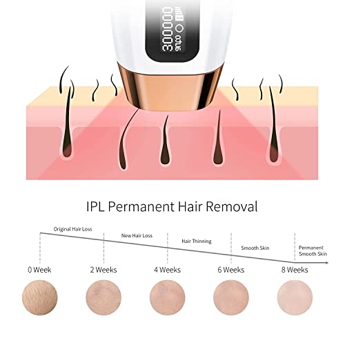 COSBEAUTY IPL Hair Removal for Women, At-Home Permanent Hair Removal Device P...