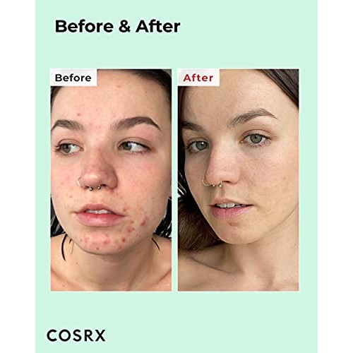 BHA 4% Blackhead Power Liquid 3.38 fl.oz / 100ml, Blackhead Remover, Pore Min...