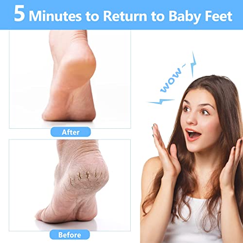 Foot Scrubber Files for Callus Remover - 32 Rows Cozycom Professional Stainle...