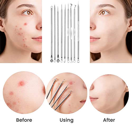 Cptots Blackhead Remover Tools 20 Pcs,Pimple Popper Tool Kit,Acne Extractor T...