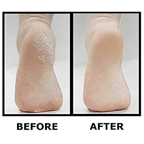 Mini Disposable Pumice Sponge Block 400 Pcs - Callus Remover for Feet Heels Palm