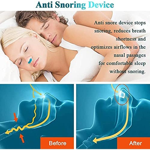 Anti Snoring Devices[Upgrade 2-in-1] Snore Stopper Snoring Solution Nose Vent...