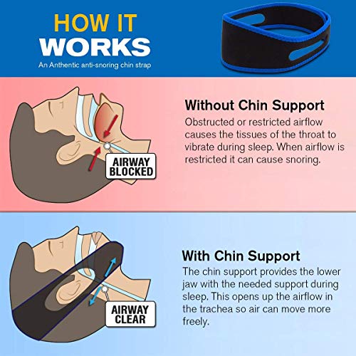 Crowndy Anti Snoring Chin Strap, Anti Snoring Devices Effective Stop Snoring ...
