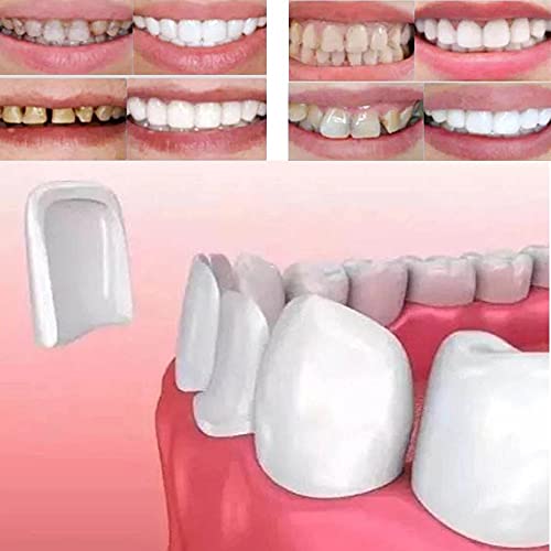 CZsy Temporary Tooth Repair kit, Teeth Veneers for Fix The Missing Tooth Teac...