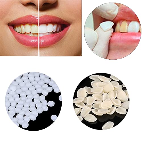 CZsy Temporary Tooth Repair kit, Teeth Veneers for Fix The Missing Tooth Teac...