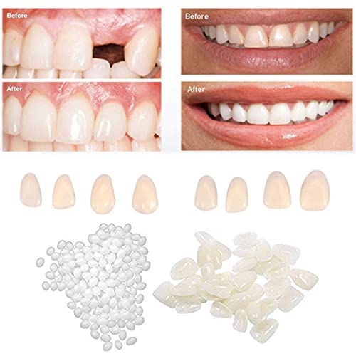 CZsy Temporary Tooth Repair kit, Teeth Veneers for Fix The Missing Tooth Teac...