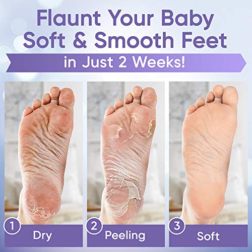 ﻿﻿Foot Peel Mask (2 Pairs) - Foot Mask for Baby soft skin - Remove Dead Skin ...