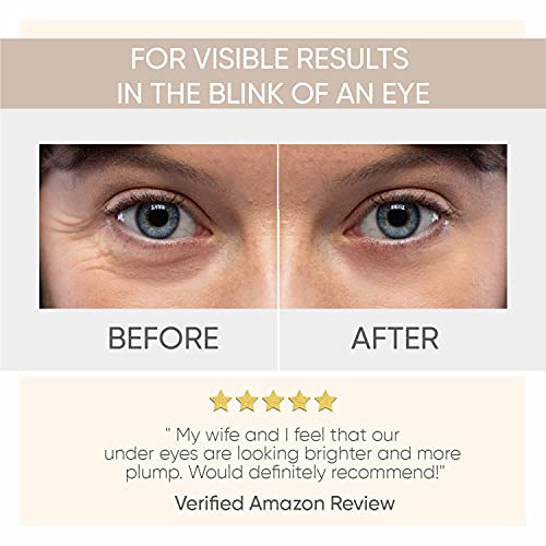 Under Eye Patches (20 Pairs) - Gold Under Eye Mask Amino Acid & Collagen, Und...